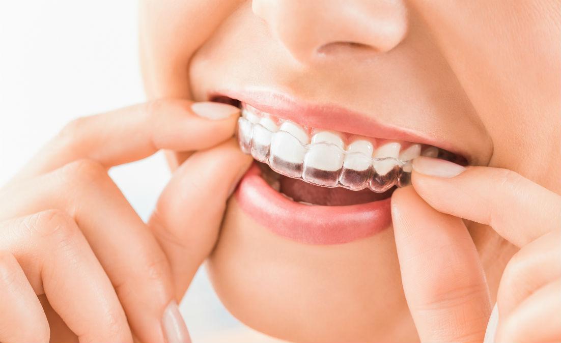 Invisalign Nashua, NH